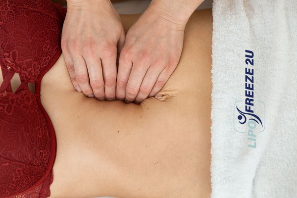 diastasis recti treatment Lincolnshire