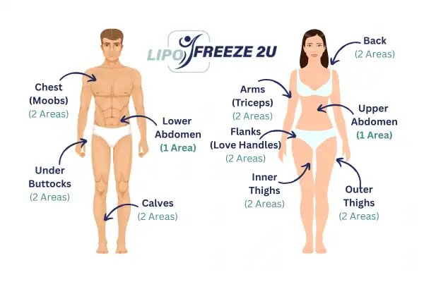 Areas you can have fat freezing treatment Lincolnshire