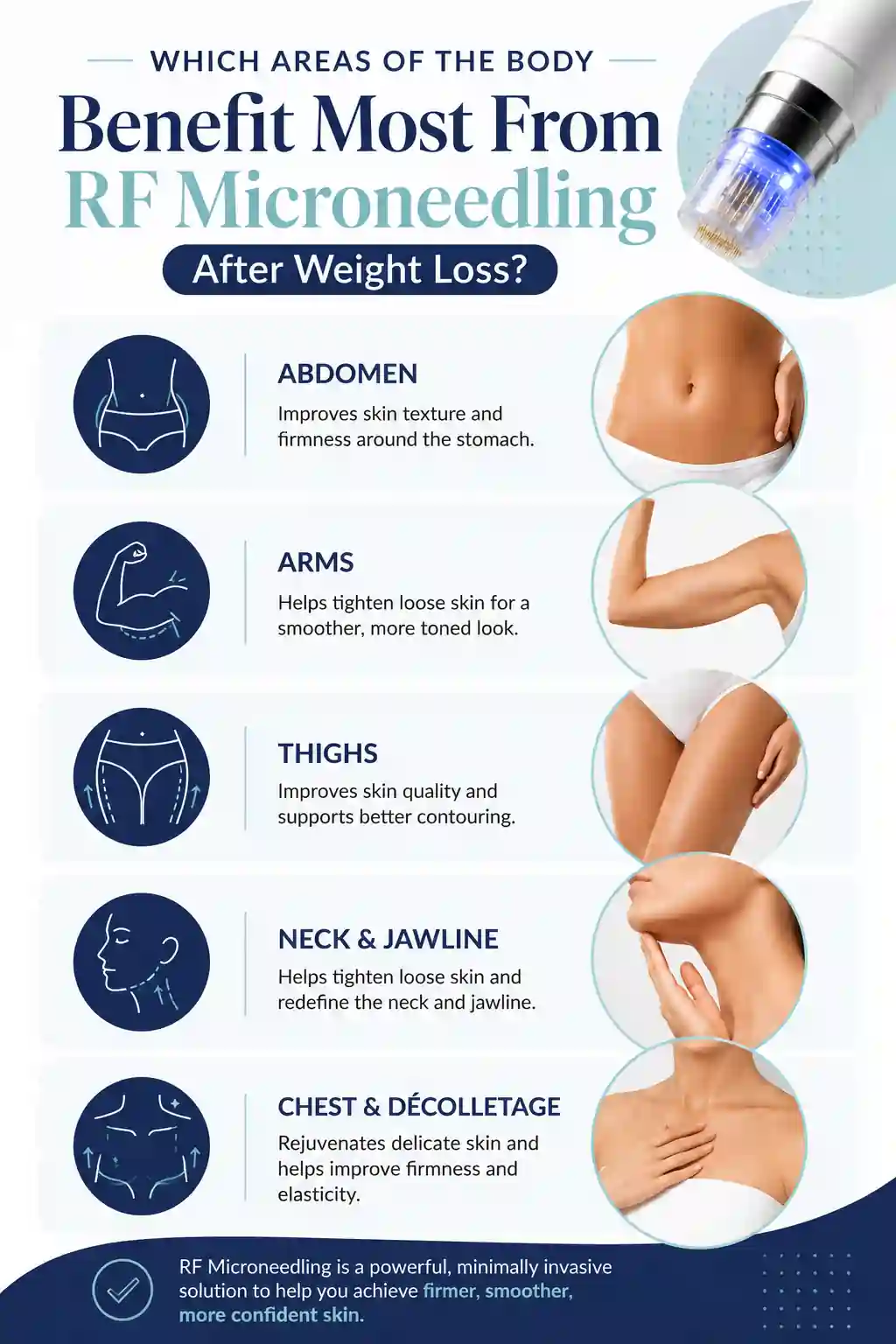 Which Areas of the Body Benefit Most From RF Microneedling After Weight Loss Lincolnshire
